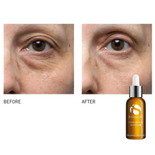 Load image into Gallery viewer, IS Clinical C Eye Serum Advance+ 15ml
